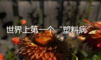 世界上第一个“塑料病”已经诞生