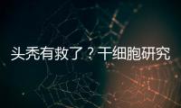 头秃有救了
？干细胞研究阐明压力如何影响毛发生长